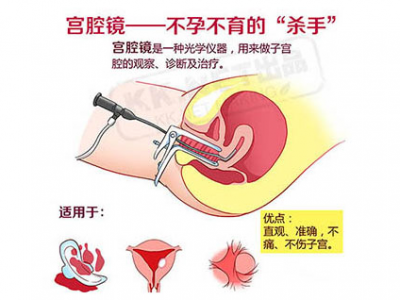非月经期间做试管检查有影响吗,女性非月经期间做试管检查有影响吗