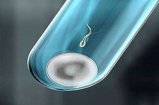 2026国内激光治疗hpv花了一万多正常吗?