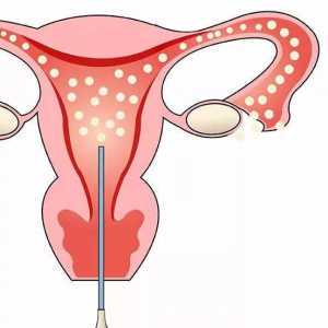 2026国内做试管婴儿费用是一次付清吗？